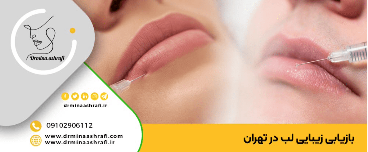 بهترین دکتر متخصص تزریق ژل ل
