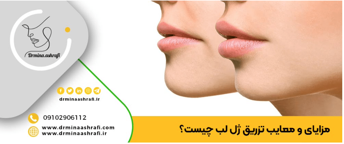 بهترین دکتر متخصص تزریق ژل ل