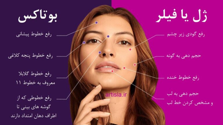 فیلر یا بوتاکس