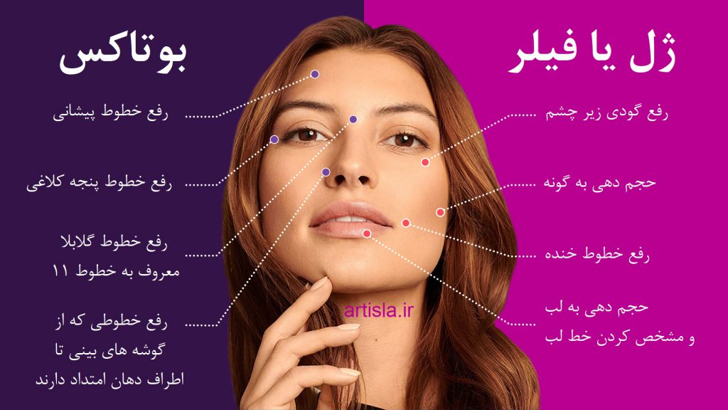 فیلر یا بوتاکس