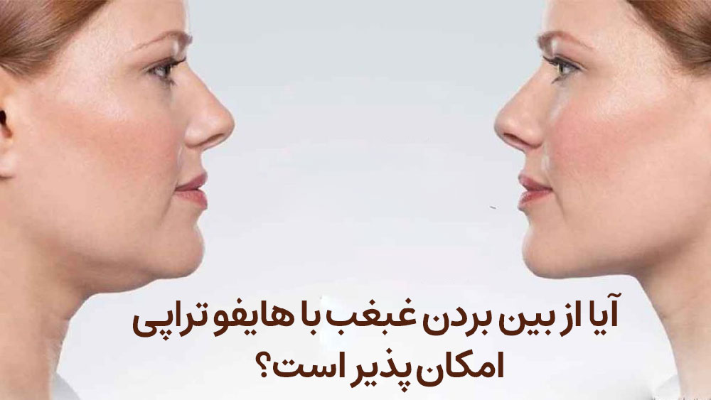 از بین بردن غبغب با هایفو تراپی