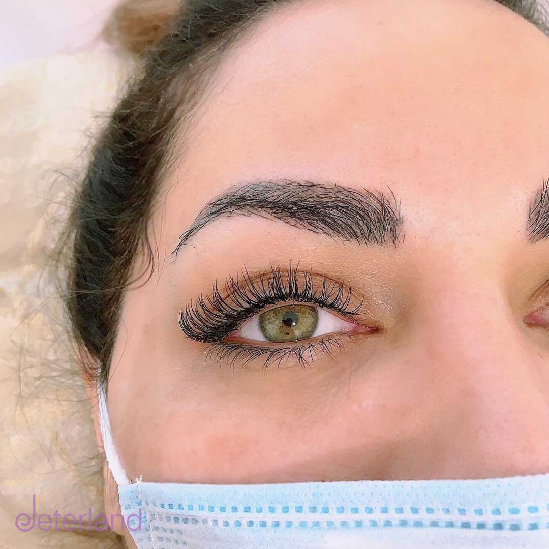 از بین بردن قرمزی چشم بعد از اکستنشن