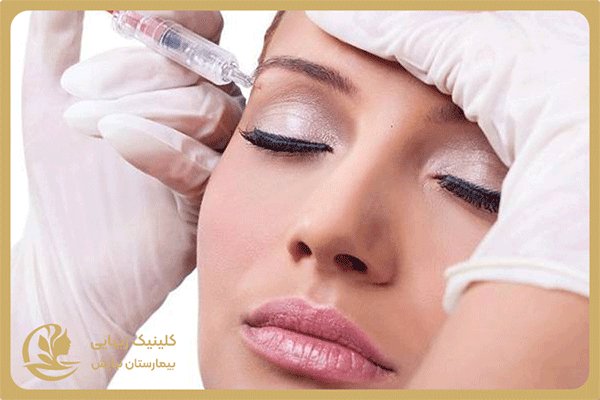 مزایای تزریق مزوژل برای تیرگی زیر چشم