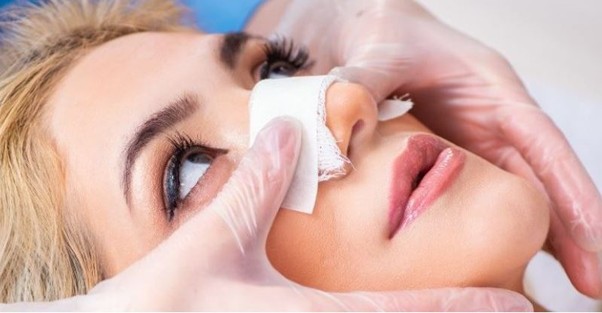 مدت زمان چسب زدن بینی گوشتی بعد از عمل